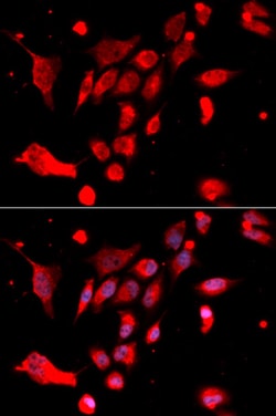 Invitrogen MAD2 Polyclonal Antibody 100 &mu;L; Unconjugated:Antibodies,