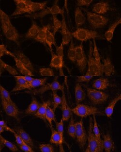 Invitrogen BRPF1 Polyclonal Antibody 100 μL; Unconjugated:Antibodies,