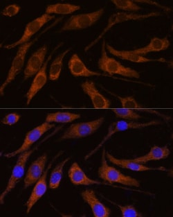 Invitrogen BRPF1 Polyclonal Antibody 100 μL; Unconjugated:Antibodies,