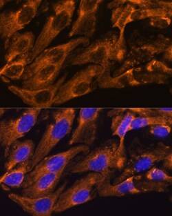 Invitrogen BRPF1 Polyclonal Antibody 100 μL; Unconjugated:Antibodies,