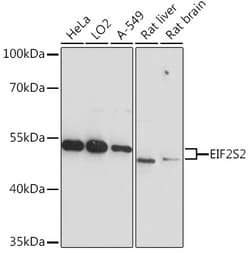 Invitrogen eIF2 beta Polyclonal Antibody 100 &mu;L | Buy Online | Invitrogen&trade; | Fisher Scientific