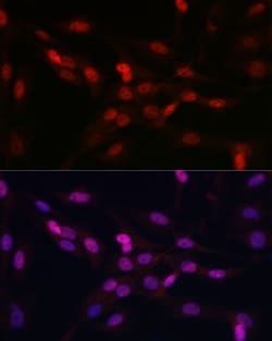 Invitrogen YAP1 Polyclonal Antibody 100 μL; Unconjugated:Antibodies,