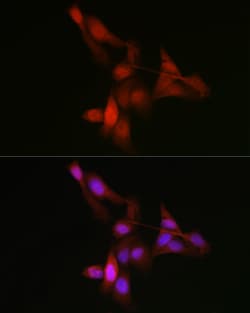 Invitrogen YAP1 Polyclonal Antibody 100 μL; Unconjugated:Antibodies,