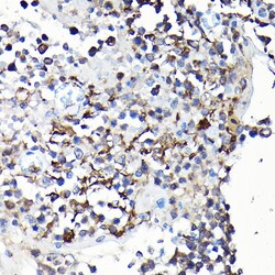 Invitrogen YAP1 Polyclonal Antibody 100 μL; Unconjugated:Antibodies,