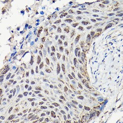 Invitrogen YAP1 Polyclonal Antibody 100 μL; Unconjugated:Antibodies,