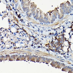 Invitrogen YAP1 Polyclonal Antibody 100 μL; Unconjugated:Antibodies,