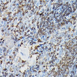 Invitrogen YAP1 Polyclonal Antibody 100 μL; Unconjugated:Antibodies,
