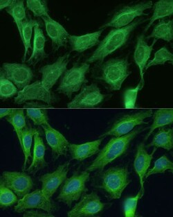 Invitrogen CNNM1 Polyclonal Antibody 100 &mu;L; Unconjugated:Antibodies,