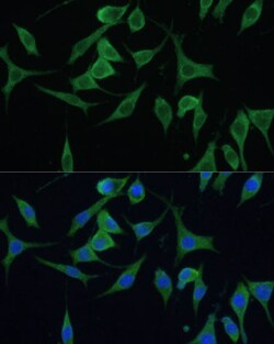 Invitrogen CNNM1 Polyclonal Antibody 100 &mu;L; Unconjugated:Antibodies,