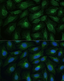 Invitrogen CNNM1 Polyclonal Antibody 100 &mu;L; Unconjugated:Antibodies,