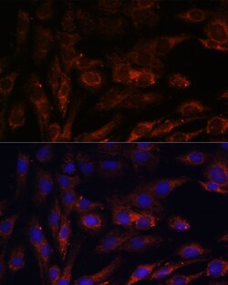 Invitrogen MRPS7 Polyclonal Antibody 100 μL; Unconjugated:Antibodies,