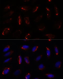Invitrogen MRPS7 Polyclonal Antibody 100 μL; Unconjugated:Antibodies,