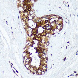 Invitrogen HSD17B7 Polyclonal Antibody 100 &mu;L; Unconjugated:Antibodies,