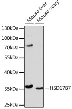 Invitrogen HSD17B7 Polyclonal Antibody 100 &mu;L; Unconjugated:Antibodies,