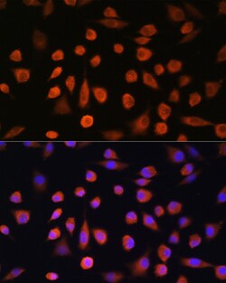 Invitrogen EDEM2 Polyclonal Antibody 100 &mu;L; Unconjugated:Antibodies,