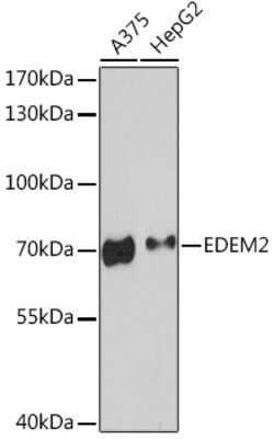 Invitrogen EDEM2 Polyclonal Antibody 100 &mu;L; Unconjugated:Antibodies,