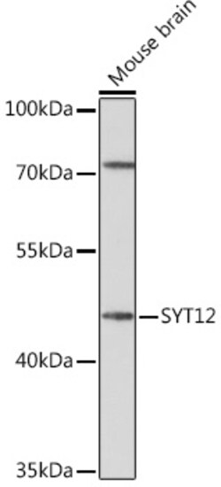 Invitrogen SYT12 Polyclonal Antibody 100 &mu;L | Buy Online | Invitrogen&trade; | Fisher Scientific