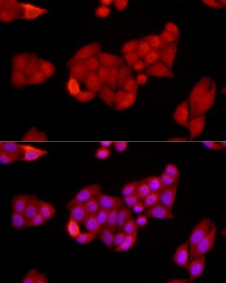 Invitrogen SIRT1 Polyclonal Antibody 100 &mu;L; Unconjugated:Antibodies,
