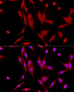 Invitrogen SIRT1 Polyclonal Antibody 100 &mu;L; Unconjugated:Antibodies,
