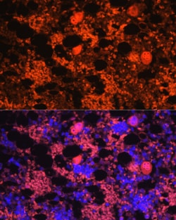 Invitrogen PF4 Polyclonal Antibody 100 &mu;L; Unconjugated:Antibodies,