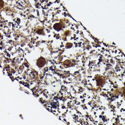 Invitrogen PF4 Polyclonal Antibody 100 &mu;L; Unconjugated:Antibodies,