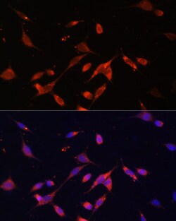 Invitrogen PIK3R2 Polyclonal Antibody 100 &mu;L; Unconjugated:Antibodies,