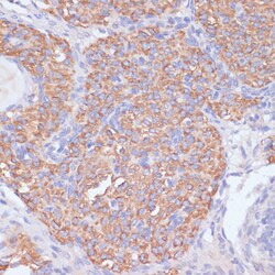 Invitrogen PIK3R2 Polyclonal Antibody 100 &mu;L; Unconjugated:Antibodies,