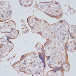 Invitrogen PIK3R2 Polyclonal Antibody 100 &mu;L; Unconjugated:Antibodies,