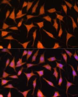 Invitrogen TIMM44 Polyclonal Antibody 100 μL; Unconjugated:Antibodies,