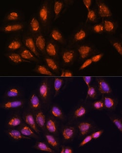 Invitrogen TIMM44 Polyclonal Antibody 100 μL; Unconjugated:Antibodies,
