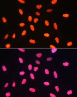 Invitrogen DNMT1 Polyclonal Antibody 100 &mu;L; Unconjugated:Antibodies,