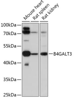 Invitrogen B4GALT3 Polyclonal Antibody 100 &mu;L | Buy Online | Invitrogen&trade; | Fisher Scientific