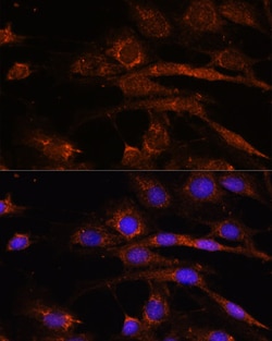 Invitrogen AP3S2 Polyclonal Antibody 100 &mu;L; Unconjugated:Antibodies,