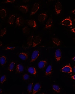 Invitrogen AP3S2 Polyclonal Antibody 100 &mu;L; Unconjugated:Antibodies,