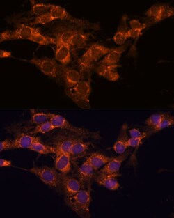 Invitrogen TMED2 Polyclonal Antibody 100 &mu;L; Unconjugated:Antibodies,