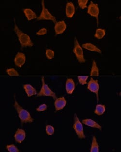 Invitrogen TMED2 Polyclonal Antibody 100 &mu;L; Unconjugated:Antibodies,