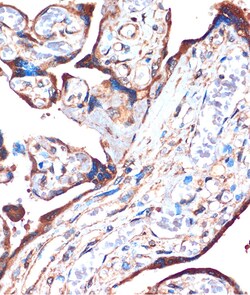 Invitrogen ZPBP Polyclonal Antibody 100 &mu;L; Unconjugated:Antibodies,