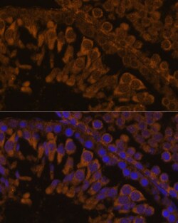 Invitrogen ZPBP Polyclonal Antibody 100 &mu;L; Unconjugated:Antibodies,