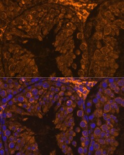 Invitrogen ZPBP Polyclonal Antibody 100 &mu;L; Unconjugated:Antibodies,