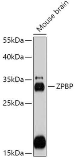 Invitrogen ZPBP Polyclonal Antibody 100 &mu;L; Unconjugated:Antibodies,