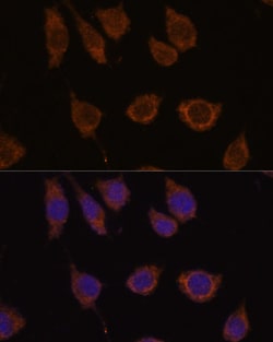 Invitrogen Carbonic Anhydrase VB Polyclonal Antibody 100 &mu;L; Unconjugated:Antibodies,