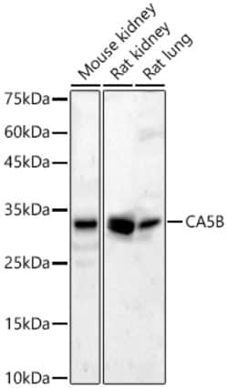 Invitrogen Carbonic Anhydrase VB Polyclonal Antibody 100 &mu;L; Unconjugated:Antibodies,