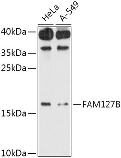 Invitrogen FAM127B Polyclonal Antibody 100 &mu;L; Unconjugated:Antibodies,