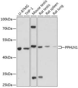 Invitrogen PPHLN1 Polyclonal Antibody 100 &mu;L; Unconjugated:Antibodies,