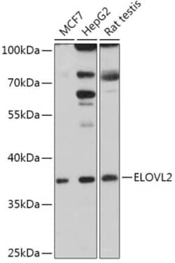 Invitrogen ELOVL2 Polyclonal Antibody 100 &mu;L; Unconjugated:Antibodies,