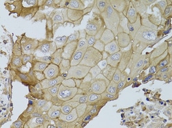 Invitrogen GGT1 Polyclonal Antibody 100 &mu;L; Unconjugated:Antibodies,