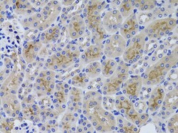 Invitrogen GGT1 Polyclonal Antibody 100 &mu;L; Unconjugated:Antibodies,