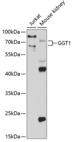 Invitrogen GGT1 Polyclonal Antibody 100 &mu;L; Unconjugated:Antibodies,