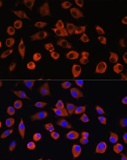Invitrogen PIGM Polyclonal Antibody 100 &mu;L; Unconjugated:Antibodies,