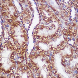 Invitrogen PIGM Polyclonal Antibody 100 &mu;L; Unconjugated:Antibodies,
